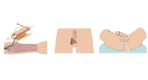 Katta kokrakli etuk ayollarning fotosuratlari